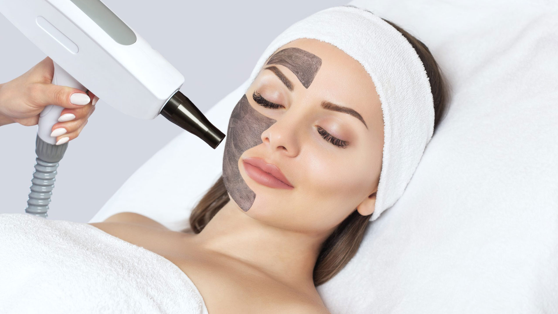 Tratamiento-de-Carbon-Activado-Hollywood-Laser-Peel-o-Carbon-Peel-en-Marbella