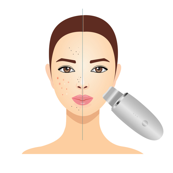 Face cleaning, ultrasonic peeling, vector